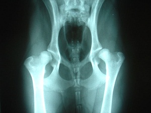 röntgen